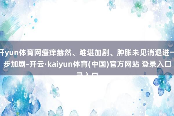 开yun体育网瘙痒赫然、难堪加剧、肿胀未见消退进一步加剧-开云·kaiyun体育(中国)官方网站 登录入口